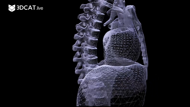 3DCAT在医疗健康行业的应用