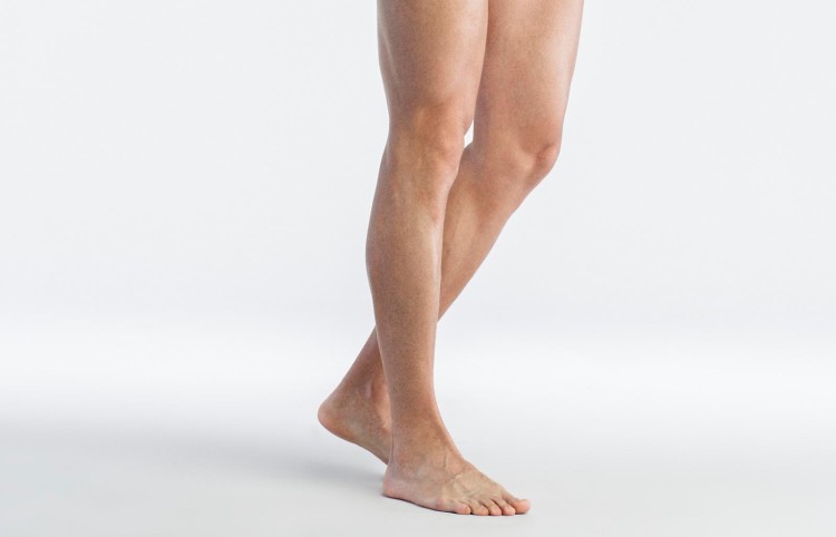Calf Reduction (Page Image)