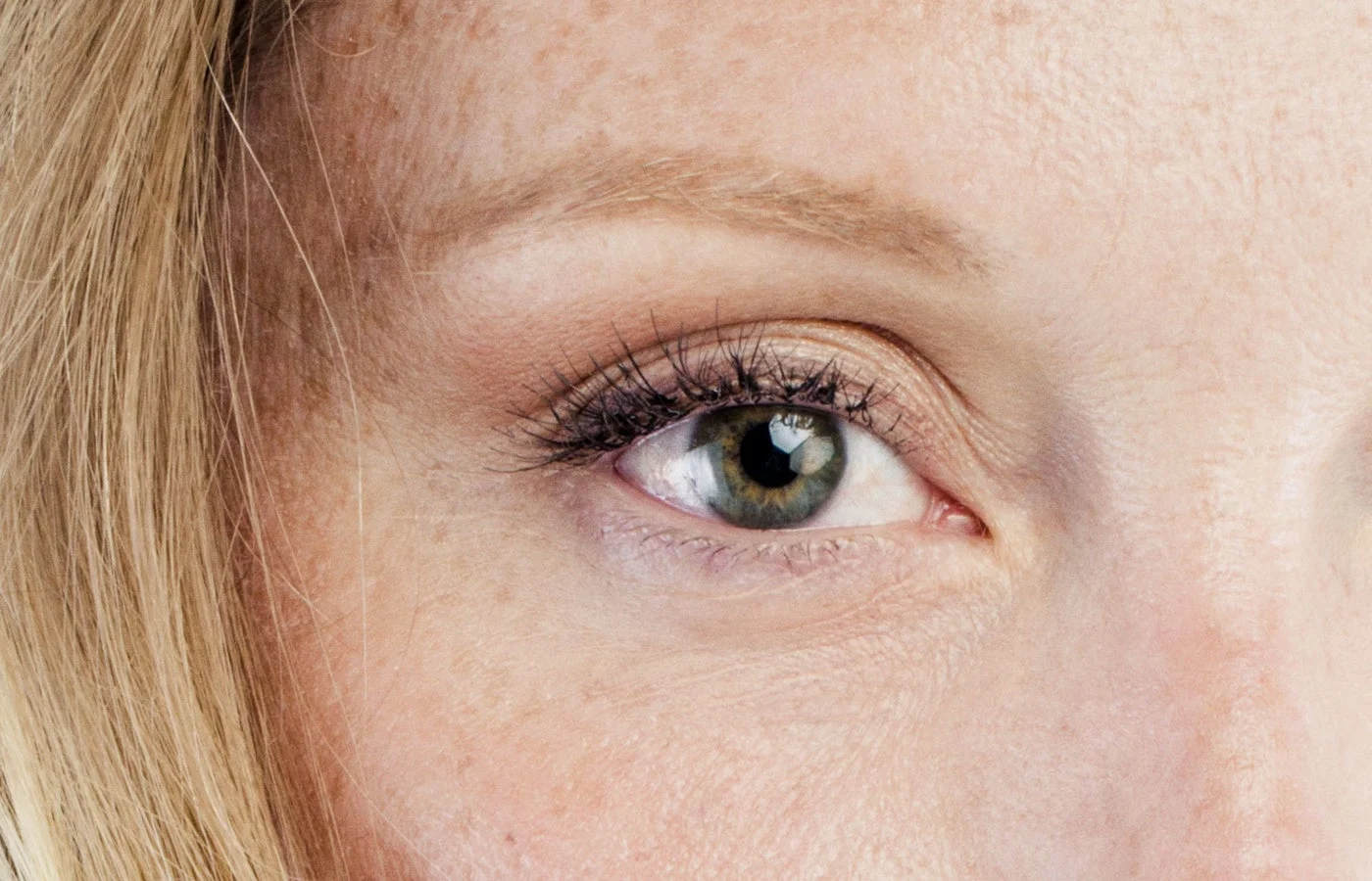 Eyelid Surgery (Page Image)