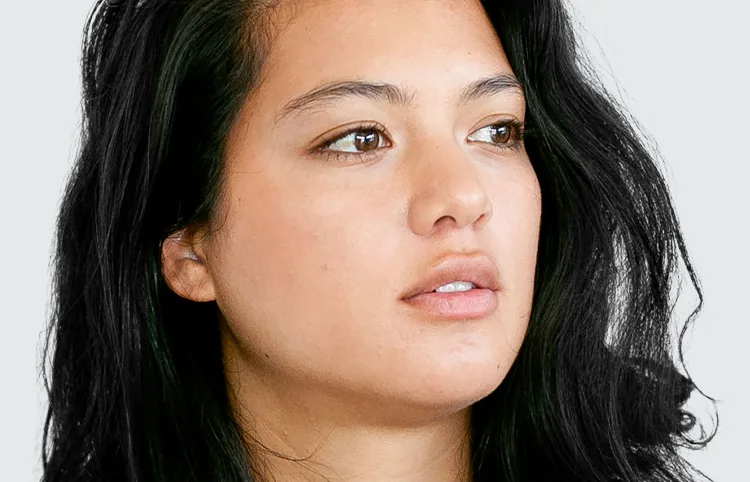 Microneedling (Page Image)