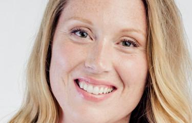 Receeding Gums 754x484