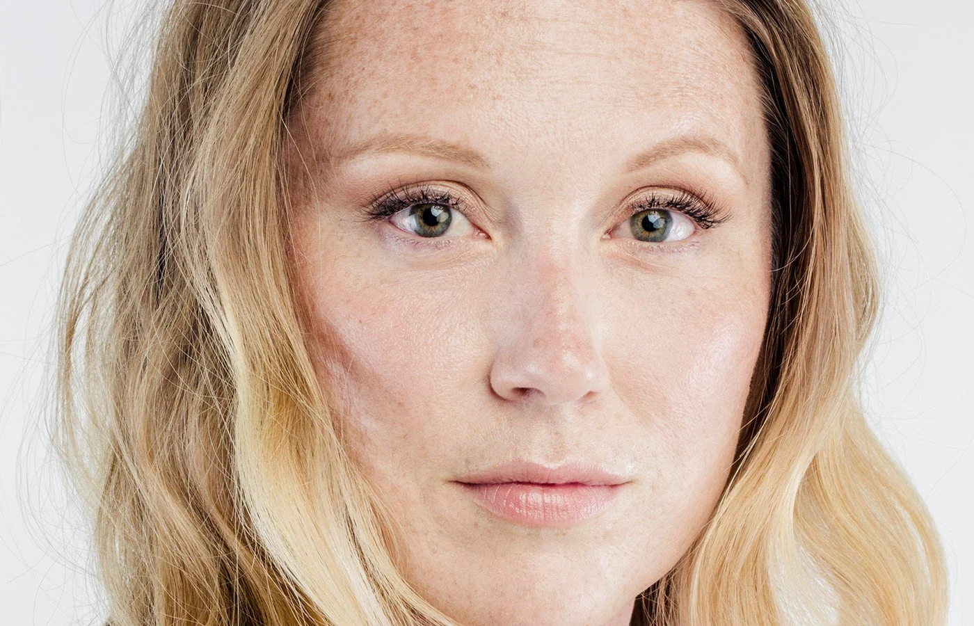 Brow Lift (Page Image)