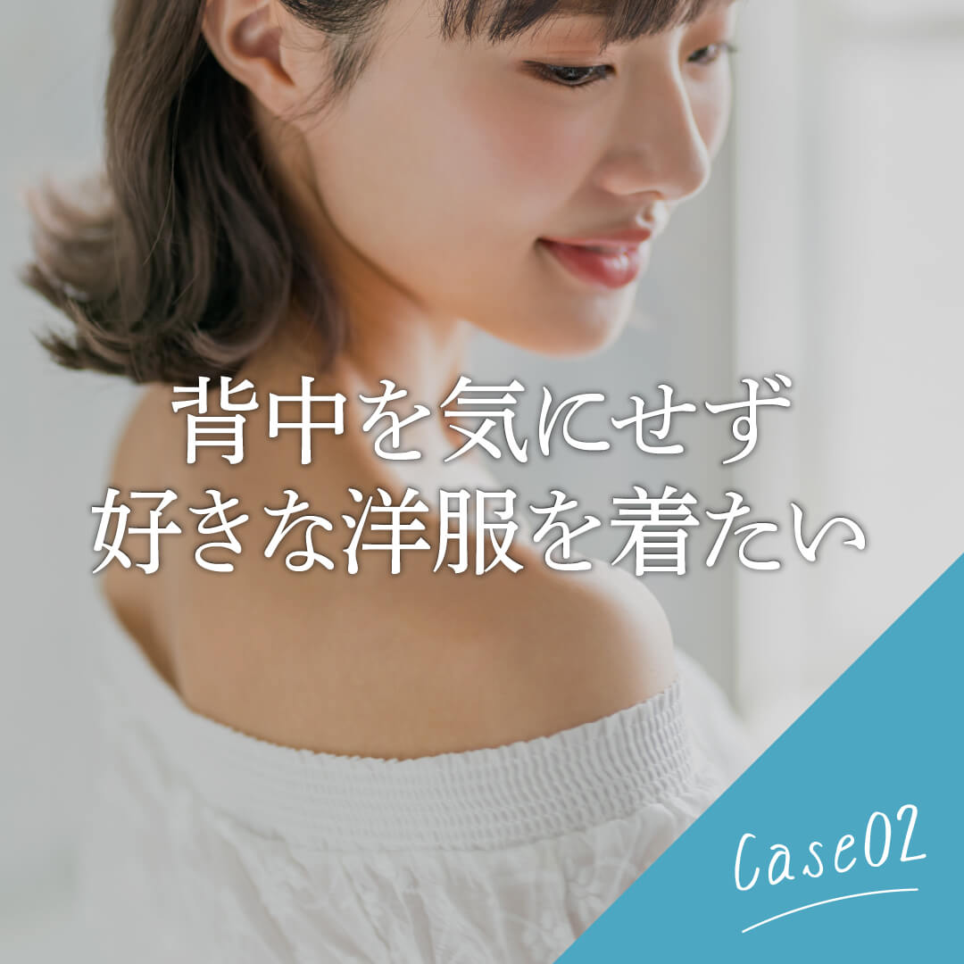 「背中ニキビケアコース」 - Image 6 - ci-z.com - ja-JP