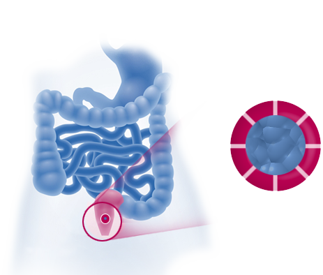 Microlax Microenema Rectal Solution