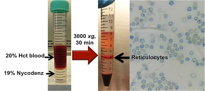 Resources reticulocyte