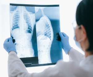 kto-leczy-osteoporoze-kto-jest-w-grupie-ryzyka