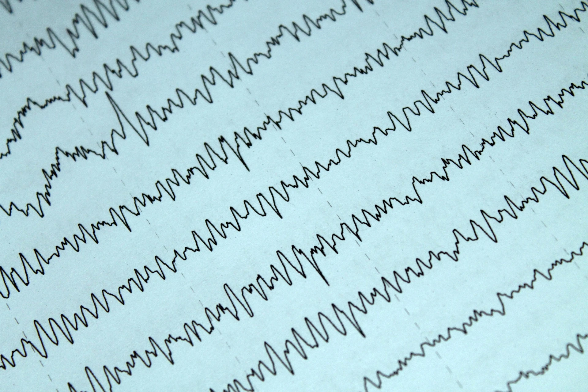 EEG – co to jest? Wskazania i przebieg badania