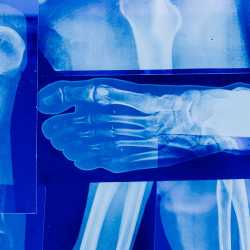 ortopeda-co-leczy-z-jakimi-objawami-udac-sie-na-wizyte