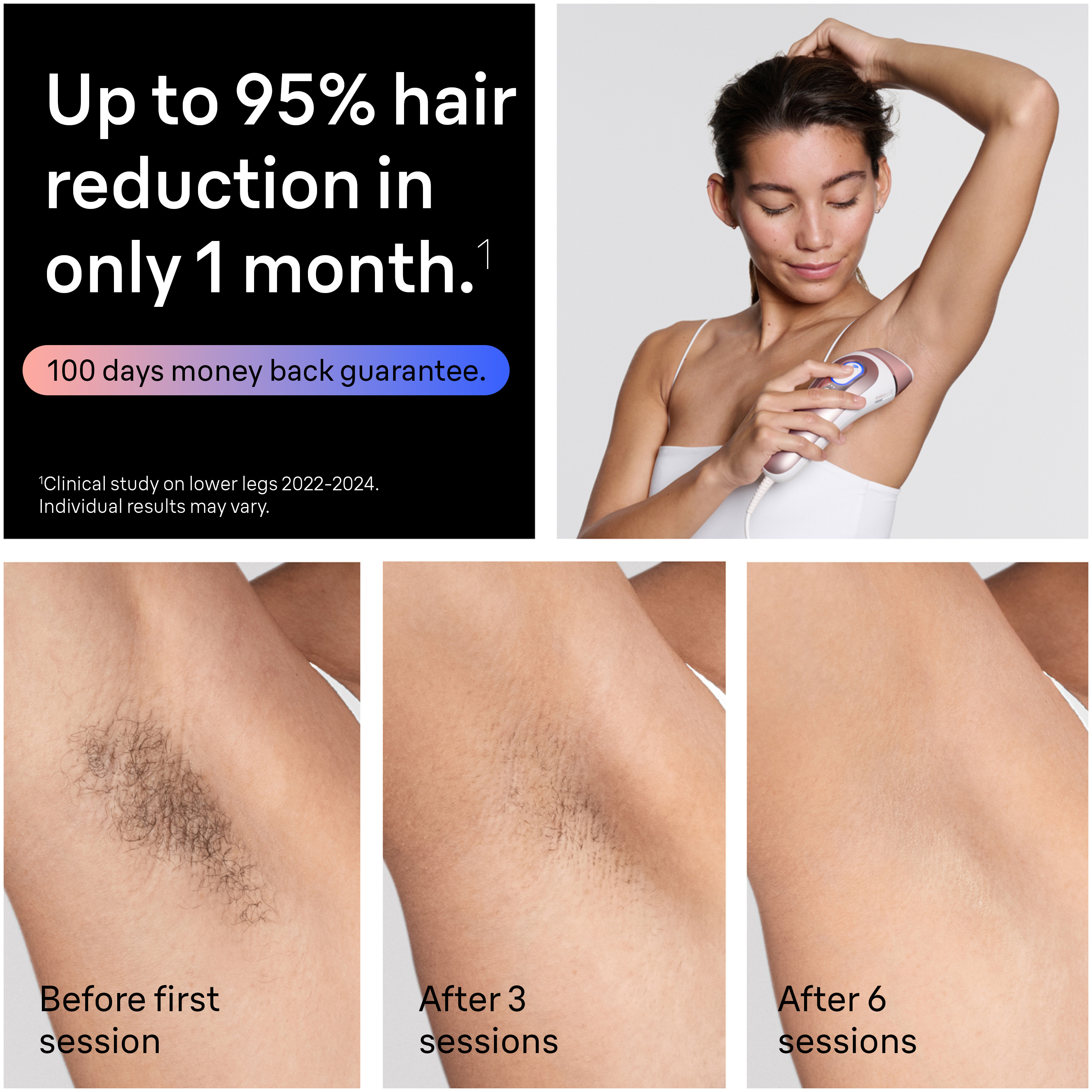 Skin i·expert Smart IPL: Laser Hair Removal PL7243 | Braun US