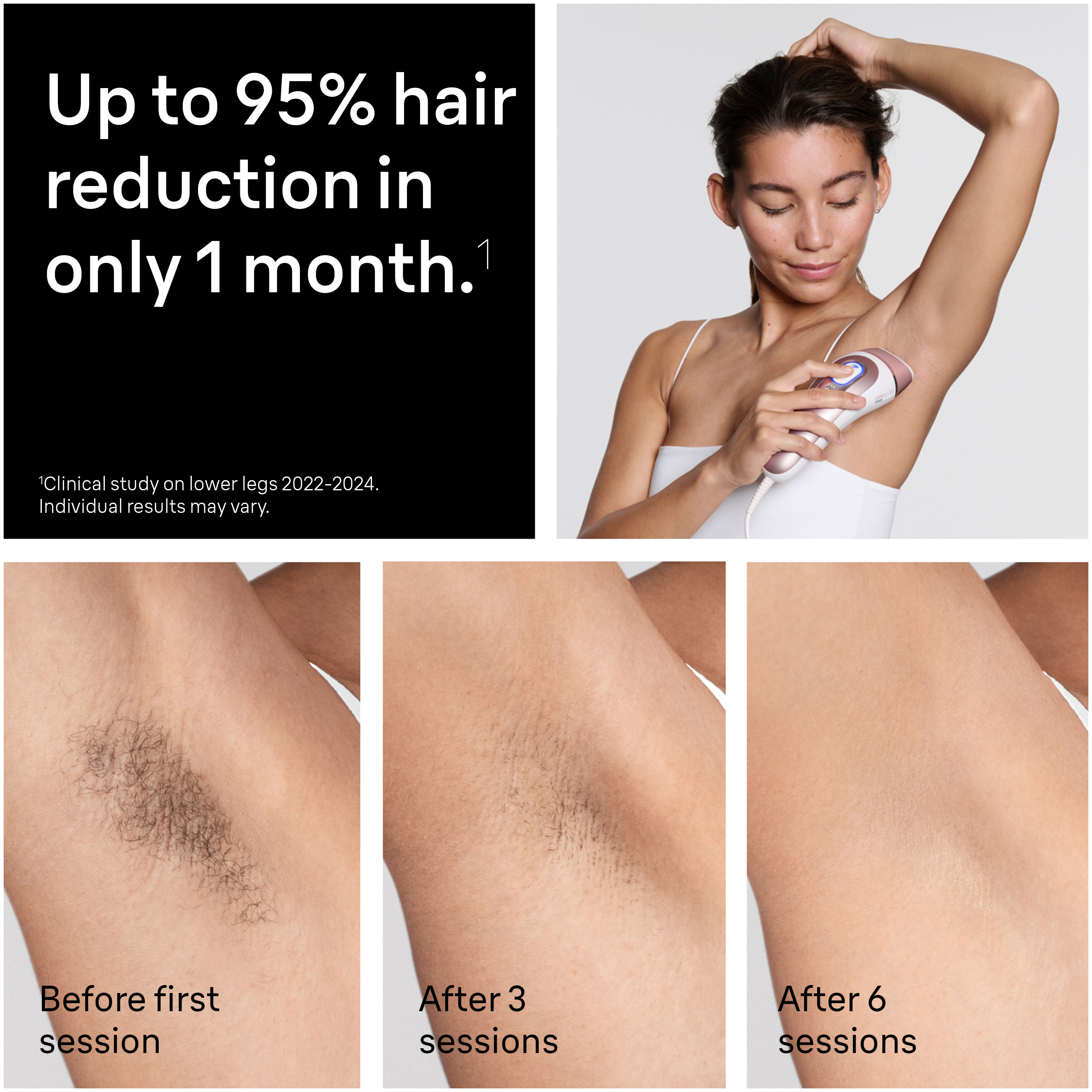 Skin i·expert Smart IPL: Laser Hair Removal PL7243 | Braun US