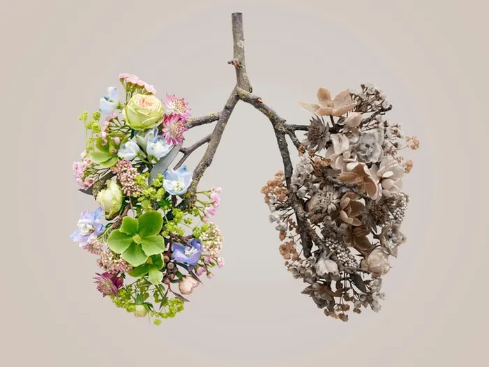 Что такое КТ легких и что оно показывает