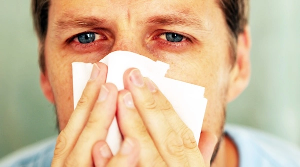 Жёлтые сопли при рините у взрослого