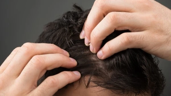 Волосистая часть головы мужчины