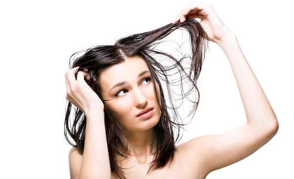 Себорейная алопеция