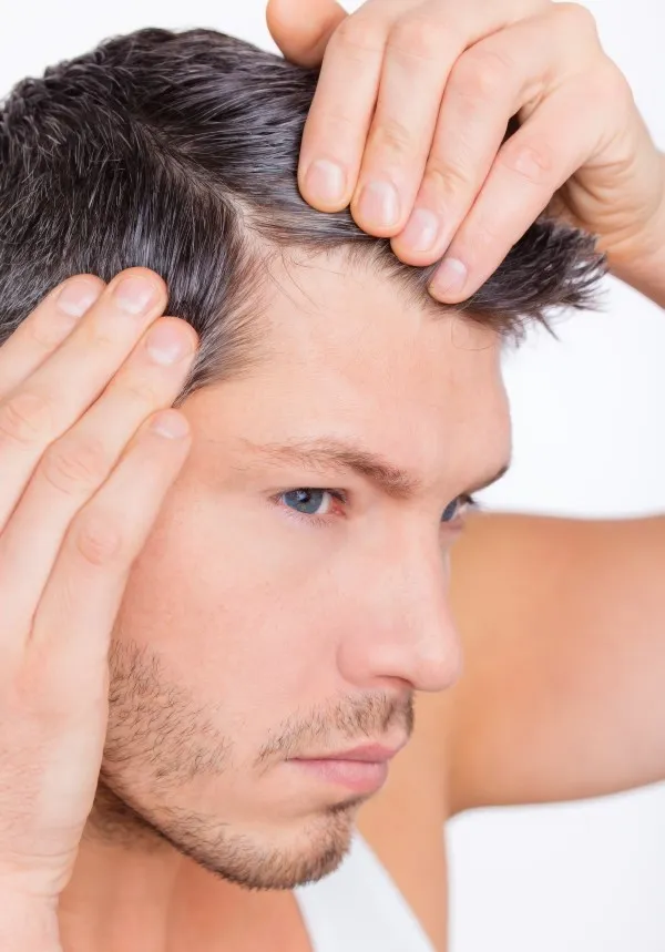 Мужчина рассматривает свои волосы и кожу головы