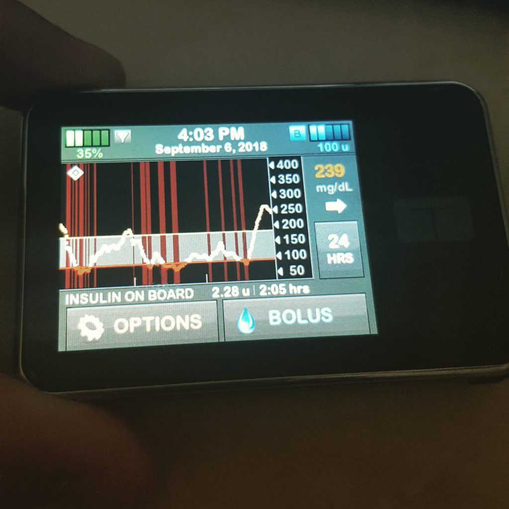 My first month running BasalIQ Tidepool