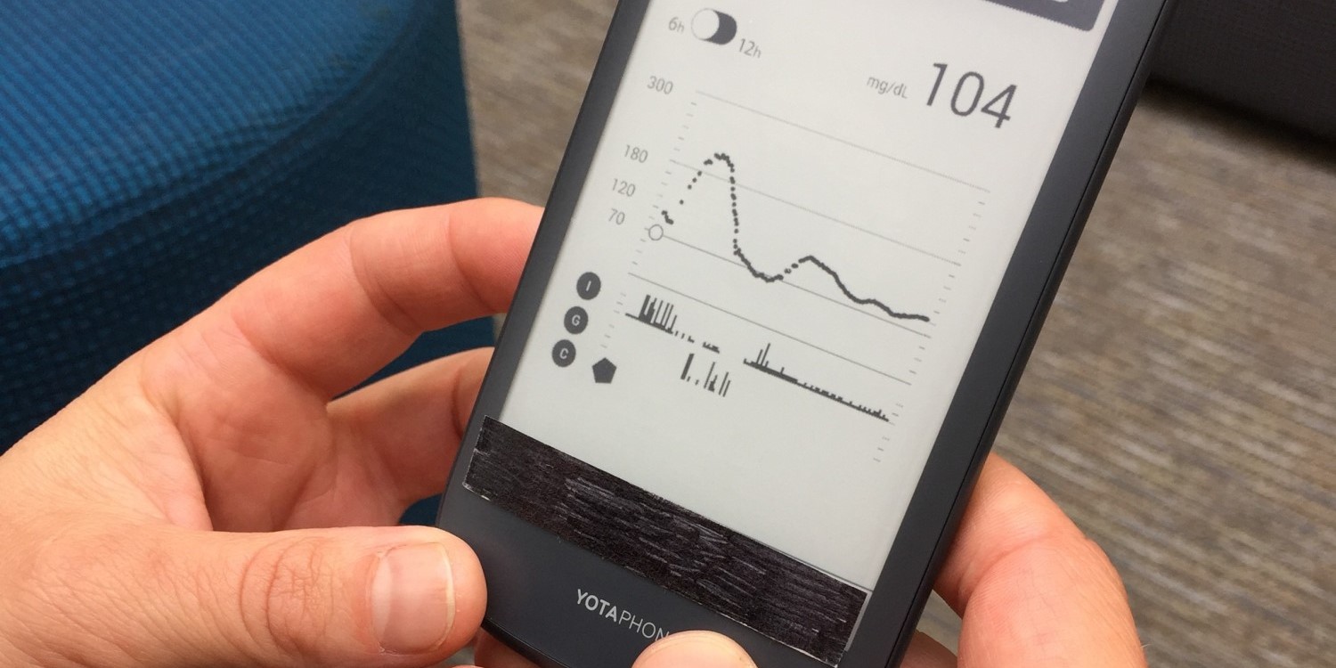 Bionic Pancreas user interface pt. 4 | Tidepool