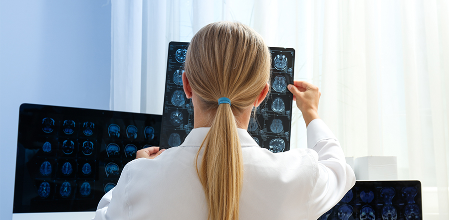 young female doctor looking at MRI image