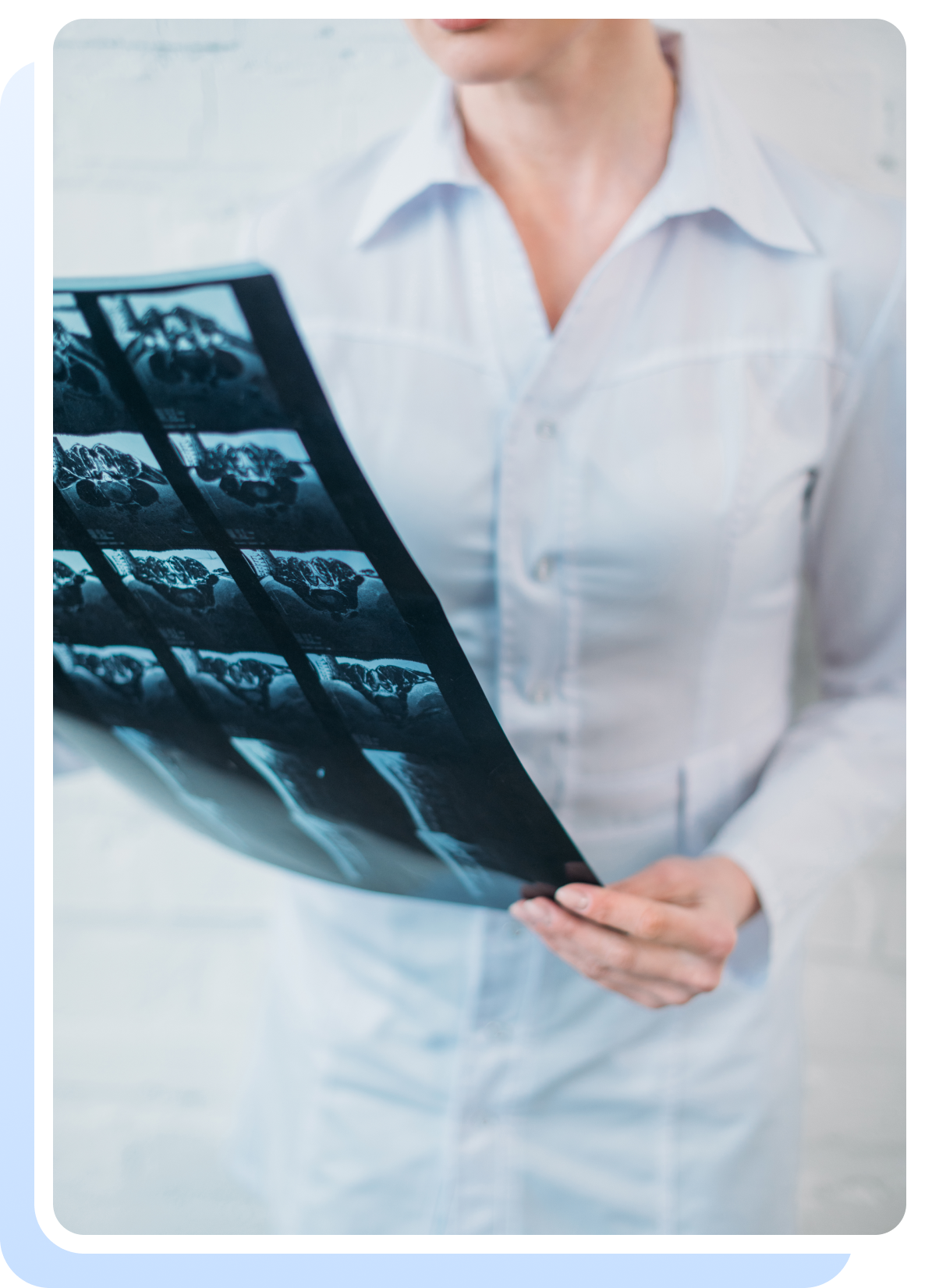 diagnosing-osteoporosis