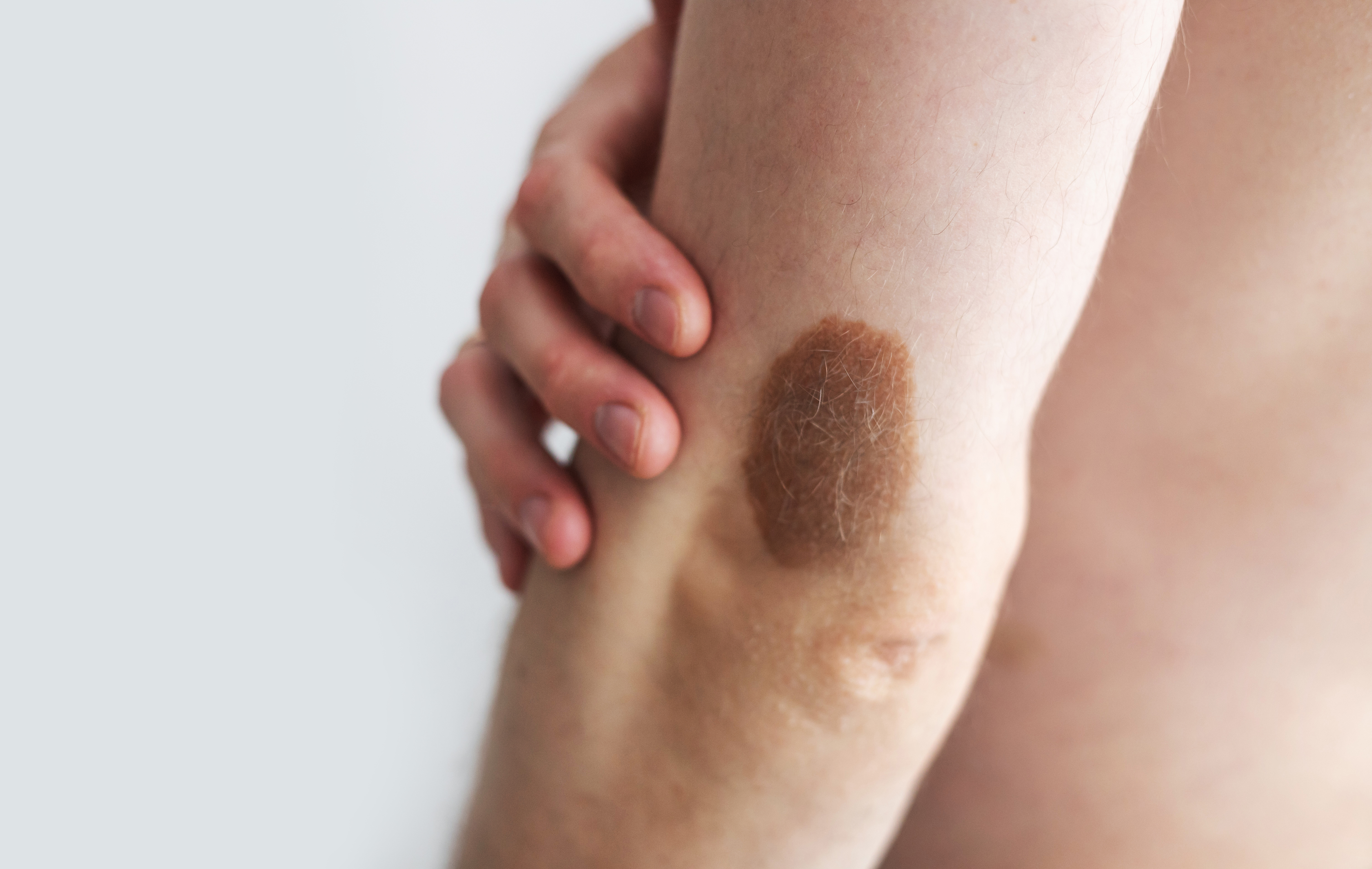 carcinoma-complications-2-mobile