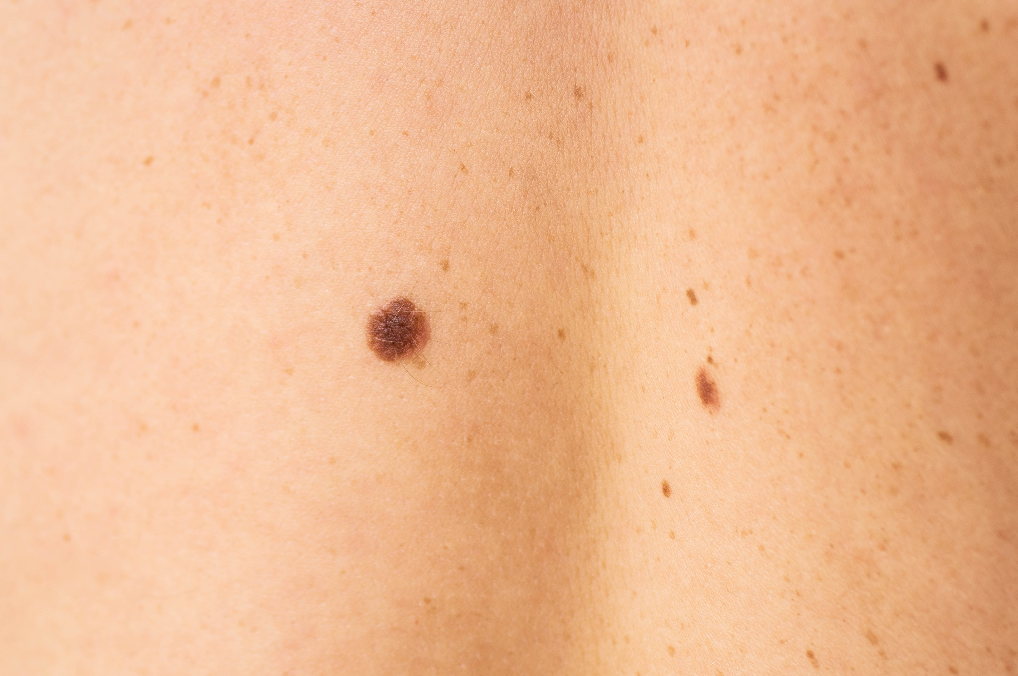 6efd1587-b8ba-5f58-98e1-84dc4a550407