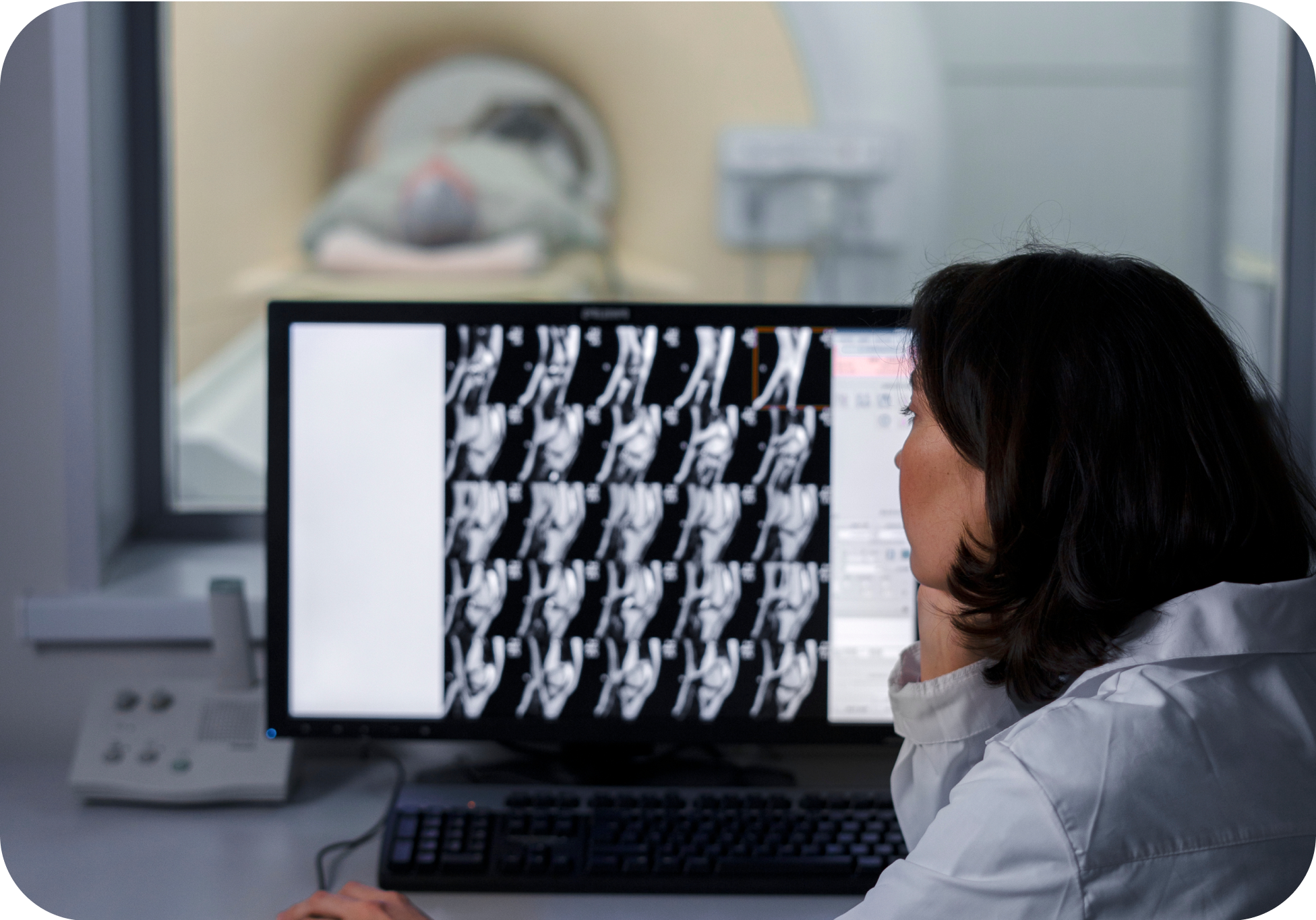 Doctor looking at X-ray image
