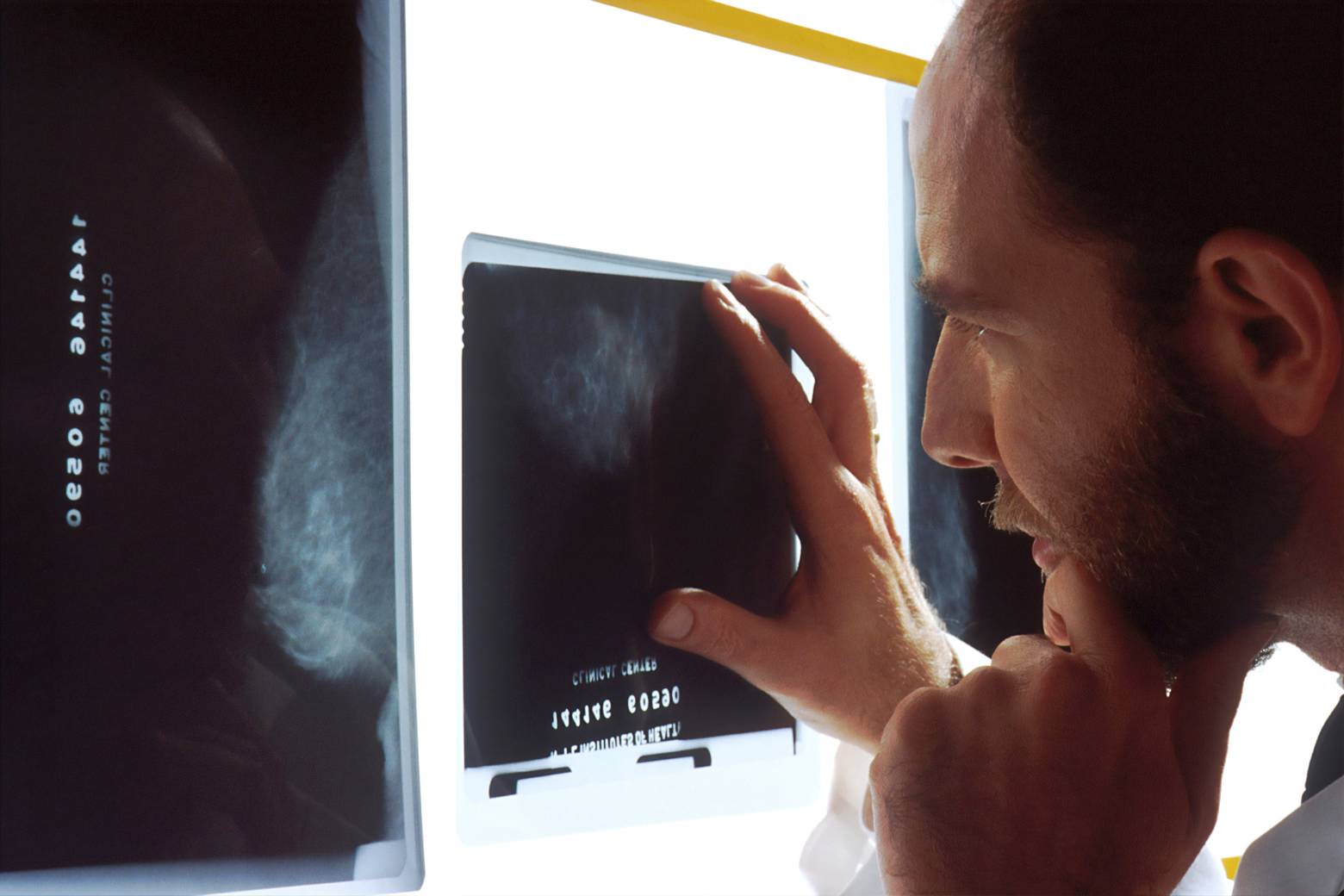 Close-up van een mannelijke arts die naar een medische scan kijkt