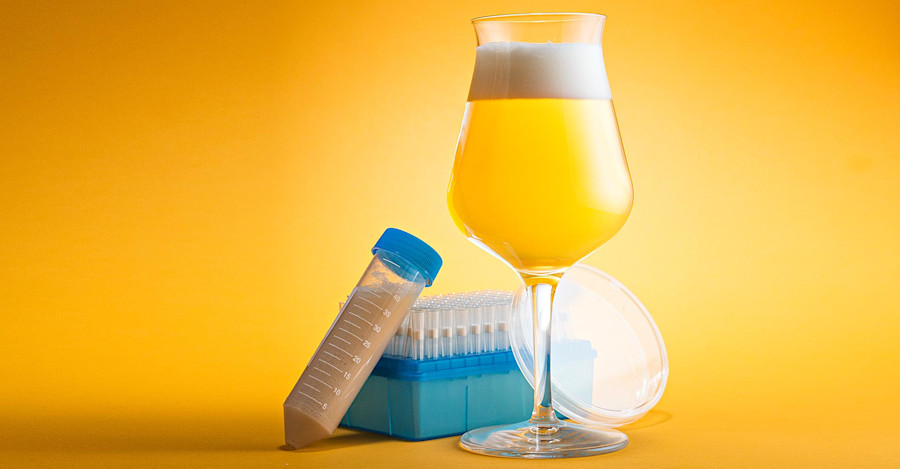 A Surprise in the Yeast Image