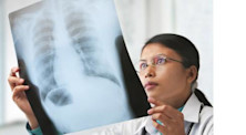معلومات عن دراسة تخصص الطب الصدري والتنفسي | information about Pulmonary Respiratory Chest medicine