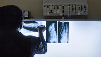 Doctor checking foot x-rays