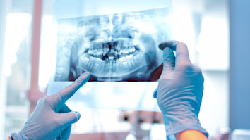 Large dentistry x-ray of mouth
