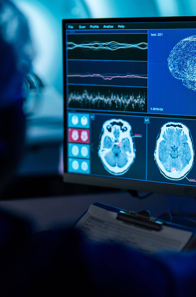 professional looking at a brain scan