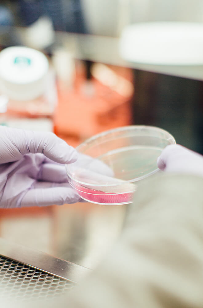 hand holding a petri dish