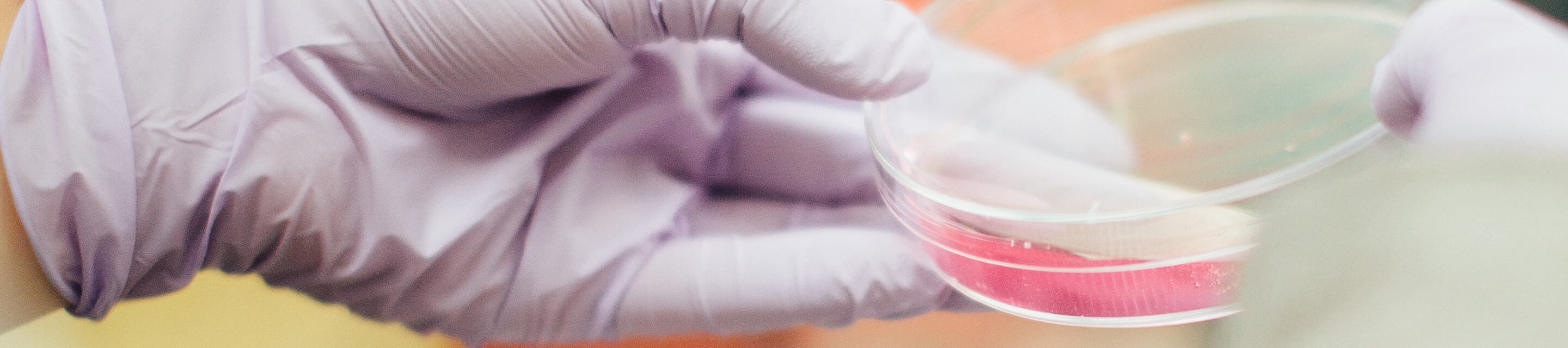 Hand holding a petri dish