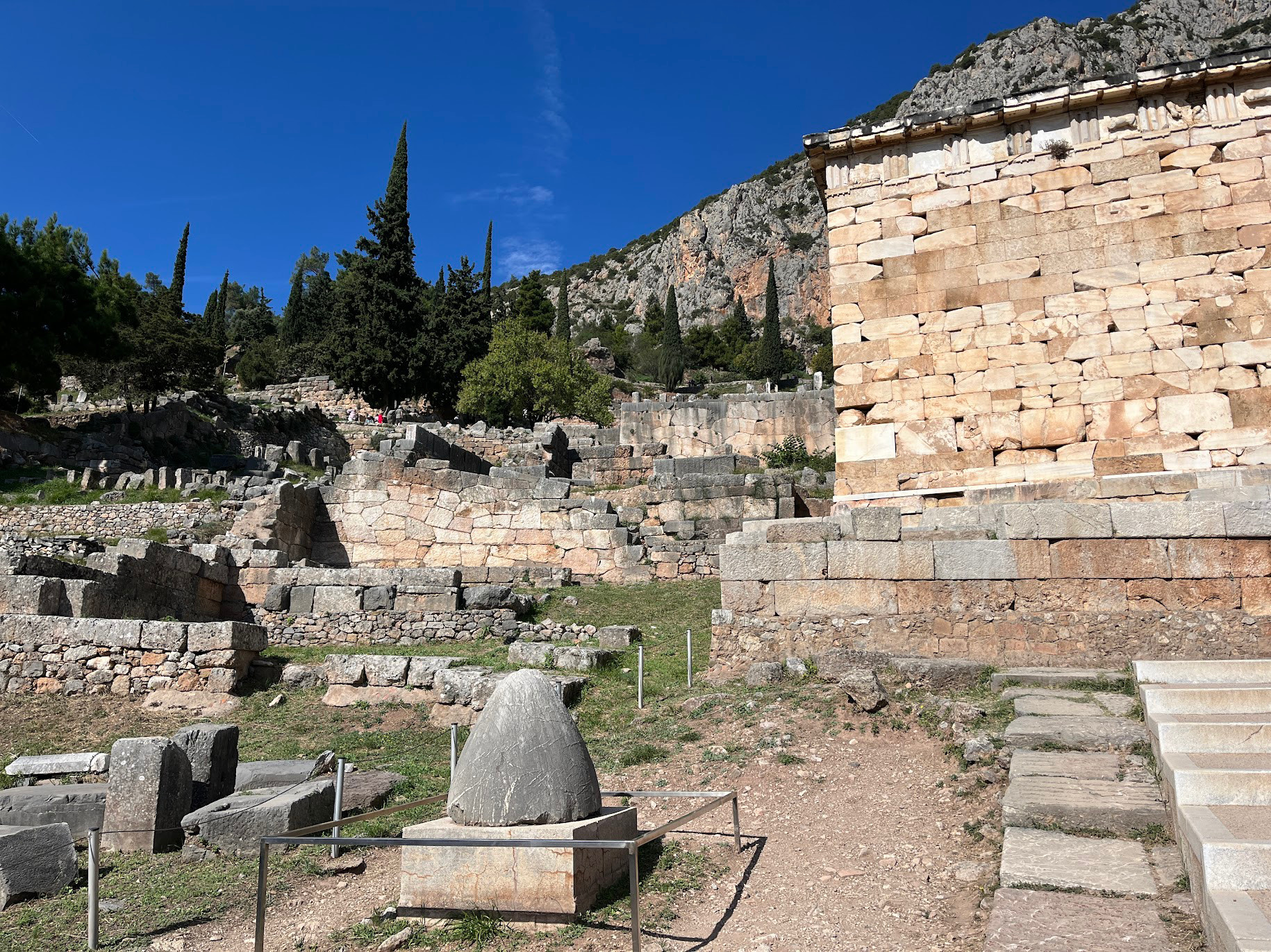 delphi belly button