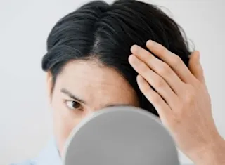 頭皮のベタつきを抑えるシャンプーの選び方|頭皮タイプ別に解説