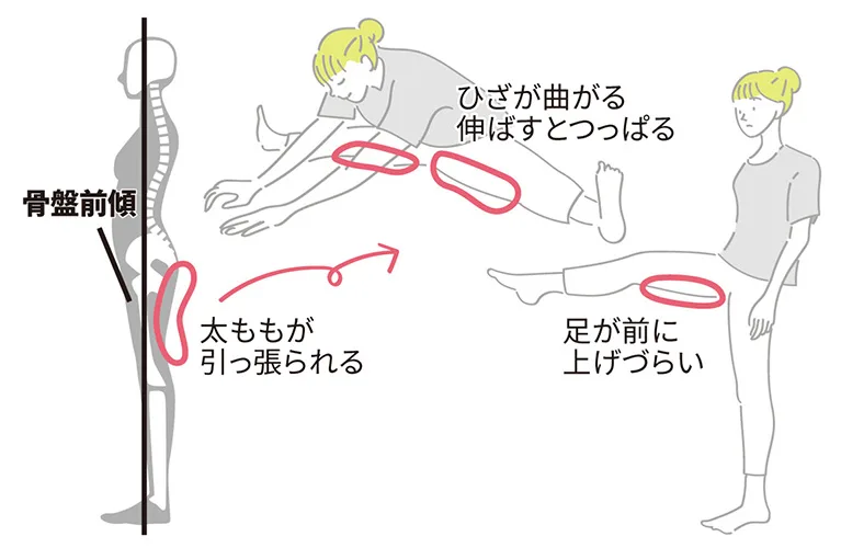 骨盤のズレが原因で股関節が柔らかくなりにくい