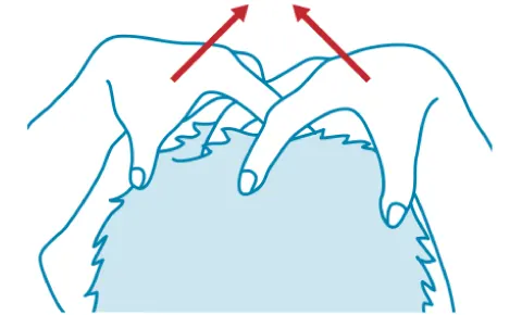 頭皮の引き上げ