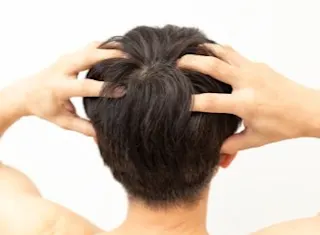冬に頭皮が乾燥する原因とは?フケ・かゆみを防ぐ正しいケア方法を解説