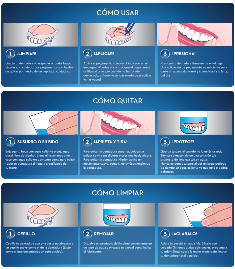 Adhesivo dental: para qué sirve y tipos