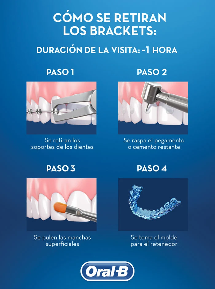 Tu última consulta de seguimiento: es hora de quitarse los brackets