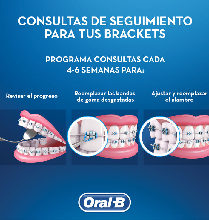 Ajuste de Brackets: qué esperar cuando visitas al dentista article link
