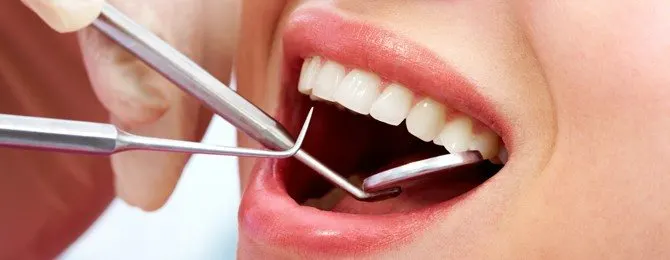 Grills dentales, una moda peligrosa para la salud bucal - Blog Salud Bucal