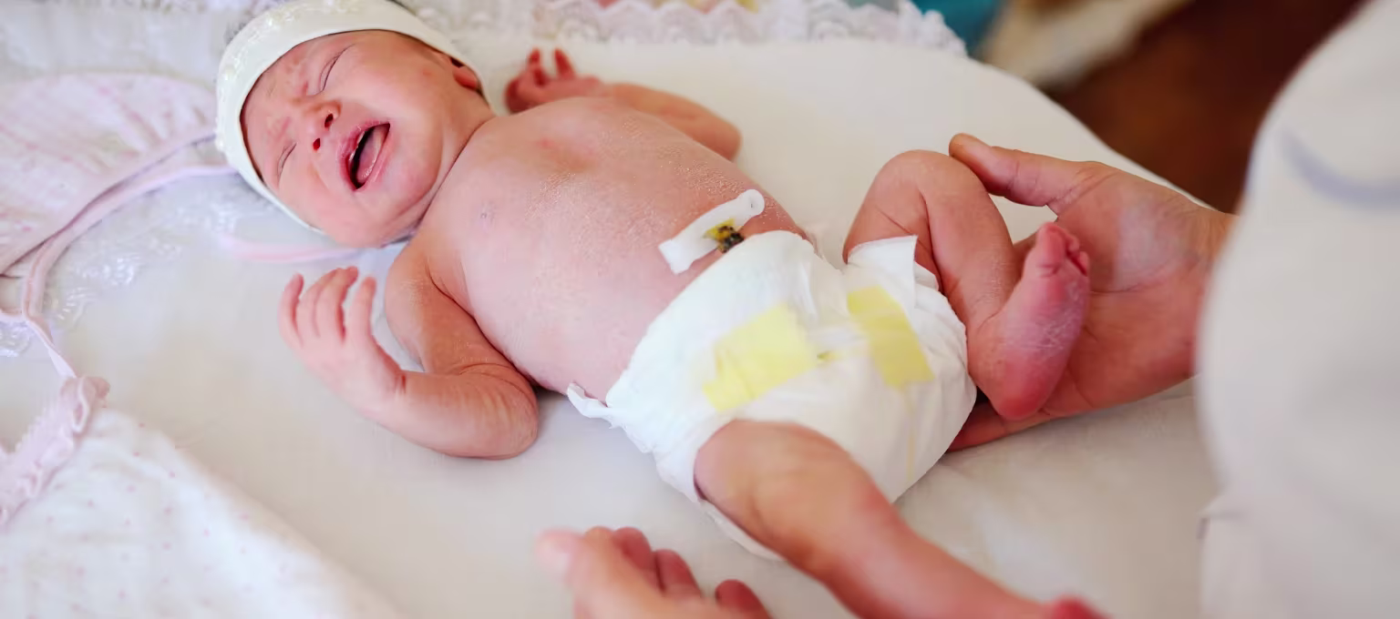 Mamá cambiando pañal a bebé con cordón umbilical