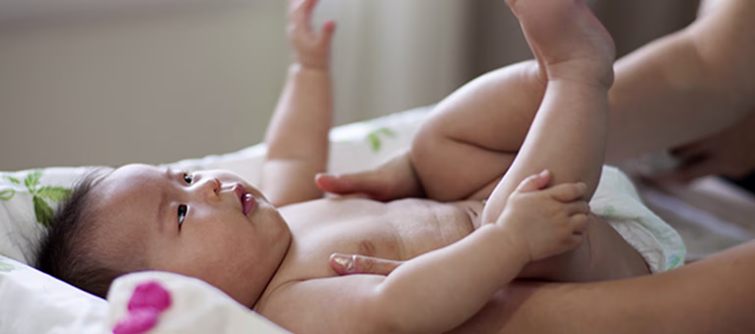 Bebé con dermatitis del pañal
