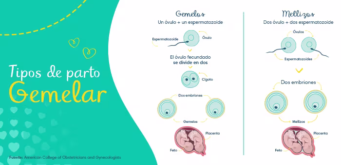 Tipos de parto gemelar
