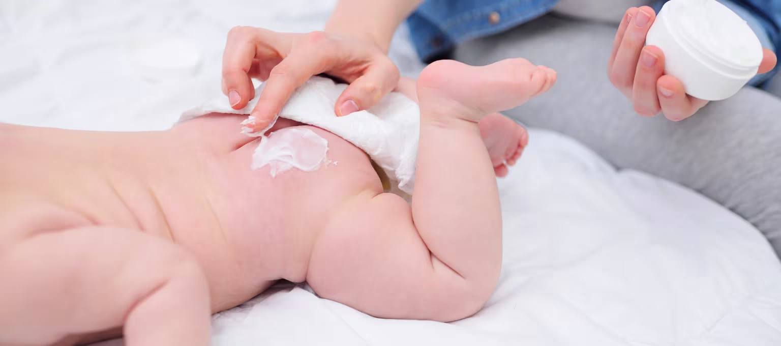 Dermatitis del pañal por levaduras: causas, síntomas y posible tratamiento