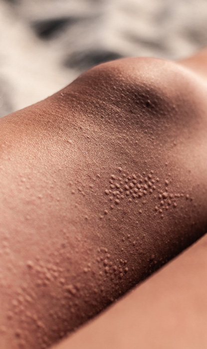 En närbild av rakhyveln på benen.