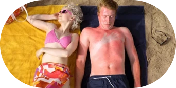 Sunburnt man and woman at the beach.