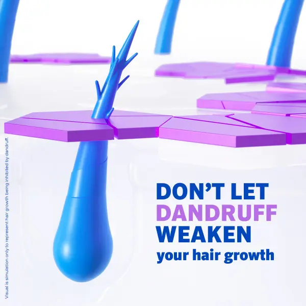 3D render of a blue hair follicle blocked by purple dandruff scales with text about hair growth 3D render of a blue hair follicle blocked by purple dandruff scales with text about hair growth